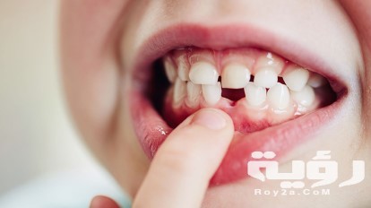 When Baby Teeth Fall Out 722x406 1