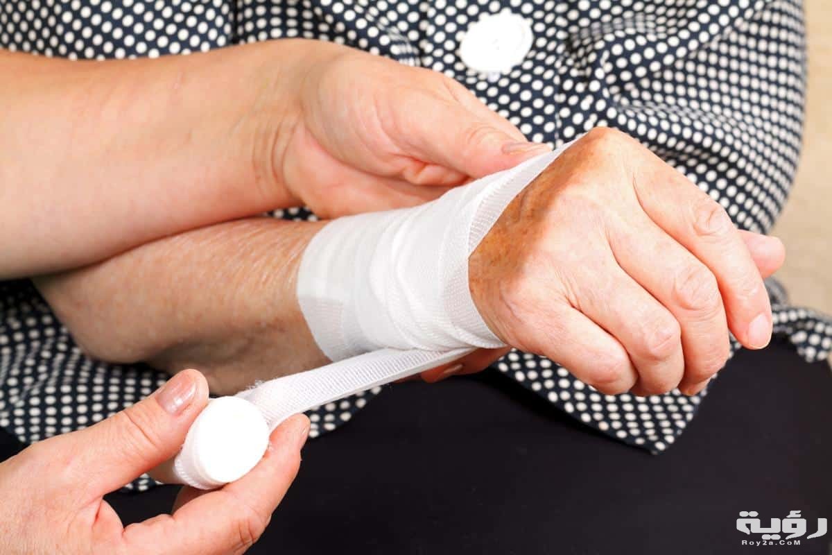 قطع اليد في المنام