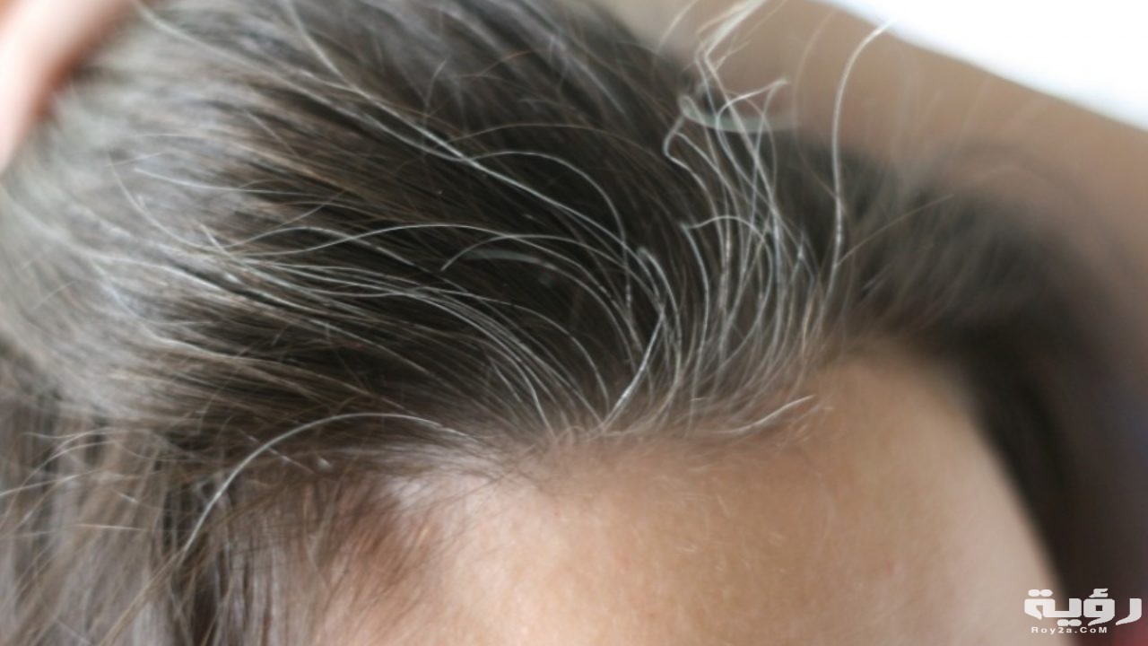 حلمت اني شعري ابيض 4 httpsrotana.netassetsuploads201702الشعر الأبيض 1280x720 1