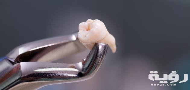 تفسير حلم خلع السن