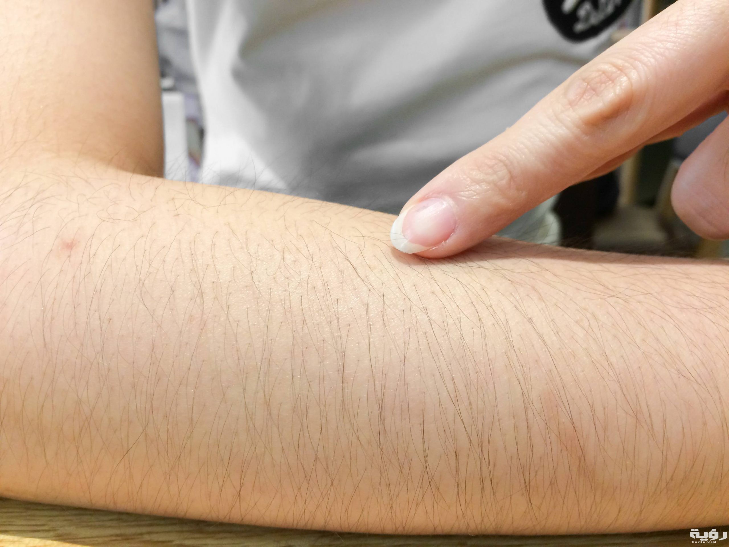 حلمت ان يدي فيها شعر 2 شعر الذراع للمرأة scaled 1