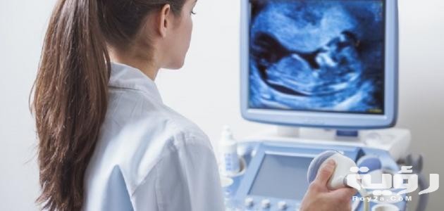 ما هو السونار