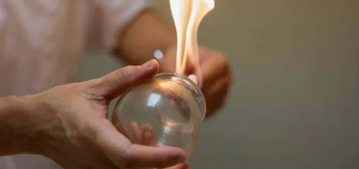 سعر الحجامة في أفضل مراكز الإمارات