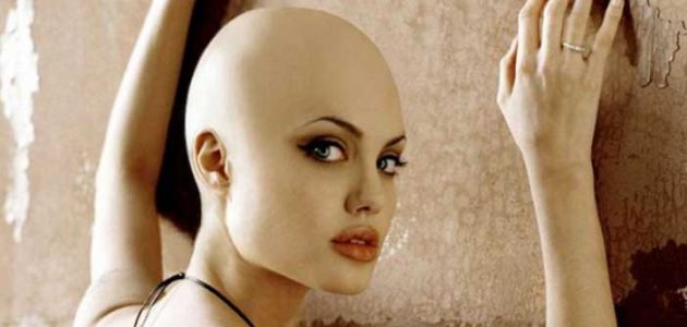 تفسير حلم رؤية المرأة الصلعاء في المنام